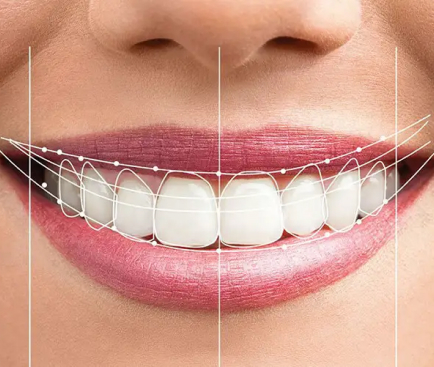 Laser-Assisted Root Canal Therapys